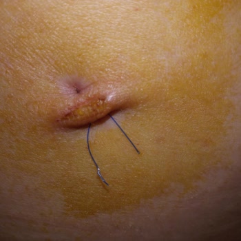 Fatih Sultan Mehmet Eğitim Ve Araştırma Hastanesi Hayatımda Böyle Dikiş Görmedim! 😡