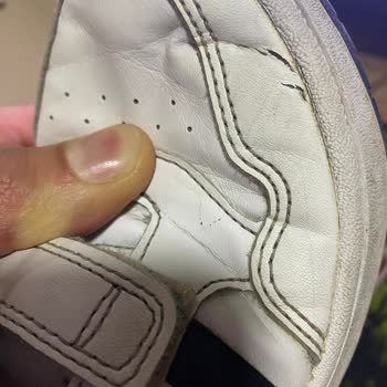 Deichmann Adidas Ayakkabı Yanlardan Açılması