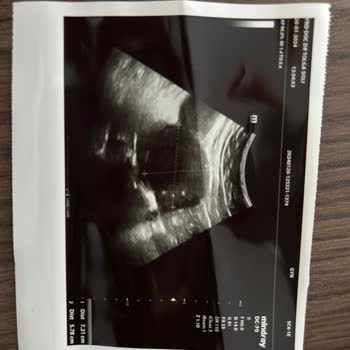 Anadolu Sigorta Özel Sağlık Sigortası Onay Sürecinde Yaşanan Sorunlar