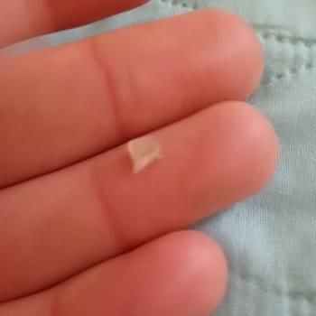 Kundakçı Yer Fıstığı (osmaniyeyerfistigi.com) Cam Kırıkları Var