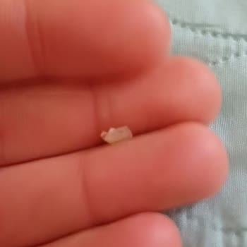 Kundakçı Yer Fıstığı (osmaniyeyerfistigi.com) Cam Kırıkları Var