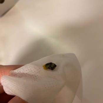 Dürümle Sipariş İçinden Taş Çıkması