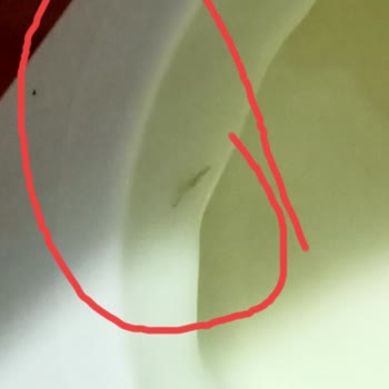 İçim Üründen Kıl Parçası Çıktı
