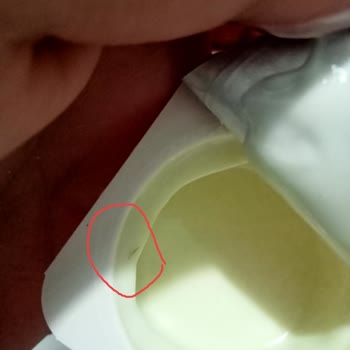 İçim Üründen Kıl Parçası Çıktı