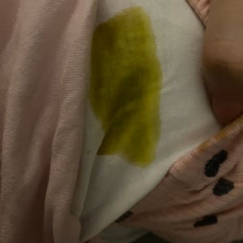 Sleepy Bebek Bezi Sızıntı Yapıyor