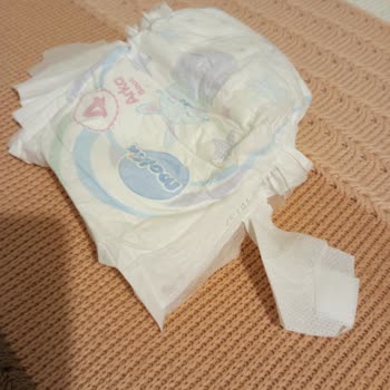 Molfix Bebek Bezi Hatası