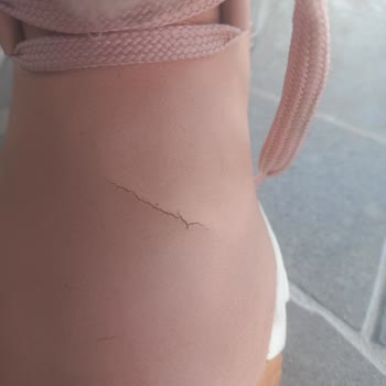 FLO Ayakkabı FLO Dan Alınan Ürün Kusuru Değerlendirmeye Alınmadı