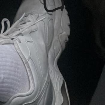 Skechers Yeni Ayakkabım Yırtıldı