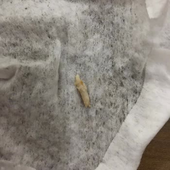 Burger King Tavuk Tırnağı Çıktı!