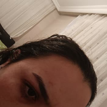 S'he Vec. Ürünler Yüzümde Yanma Sivilceler Yaptı