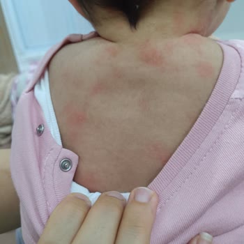 Ebebek Çalışanı İade Ürünü Red Etti