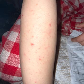 Q Life Estetik ve Güzellik Hijyen Sıfır