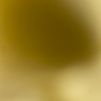 Sensodyne Dişime Ne Oldu