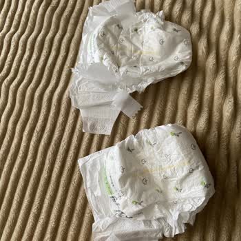 Sleepy Çocuk Bezi Kopuyor