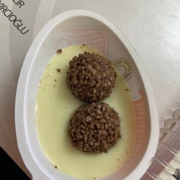Migros Kinder Joy Sürprizi: Tüy Düşüklüğü!