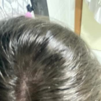 Head And Shoulders Saçımı Kepeklendirdi