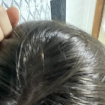 Head And Shoulders Saçımı Kepeklendirdi