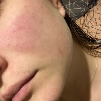 Nivea Yüz Yıkama Köpüğü