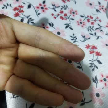 BİM Marketten Alınan Ton Balığı Ürününde Kılçık Bulundu