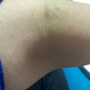 Kızılay Sağlık Bakırköy Tıp Merkezi