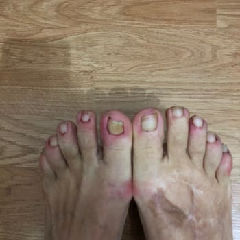 Olga Tırnak Center Pedikür Değil Resmen Doğradı