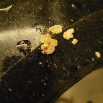 Koska Nazar Boncuklu Koska Cevizli Helva İçindeki Kabuk Dişimi Kırmama Neden Oldu