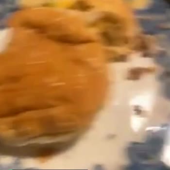 Amasya Et Ürünleri Hamburger Köftesinin İçinden Çıkan Kemik Parçaları