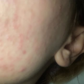 Maruderm Salisilik Asit İçeren Yüz Yıkama Jeli