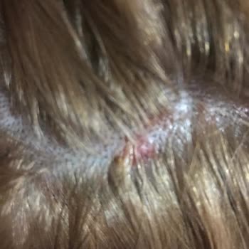 Palette краска для волос жжет кожу головы