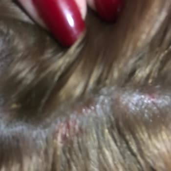 Palette краска для волос жжет кожу головы