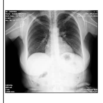 Dr. Lüleci Doktorun Yaklaşımı Ve Teşhis Sürecine İlişkin Şikayet