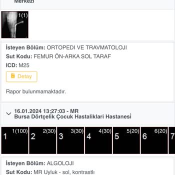 Dörtçelik Çocuk Hastalıkları Hastanesi MR Raporu Gözükmüyor.