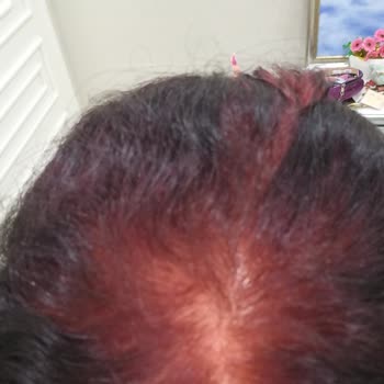 Garnier Saç Boyası Sorunu!