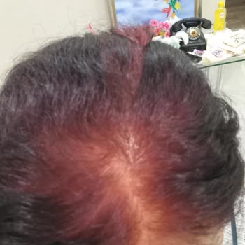 Garnier Saç Boyası Sorunu!