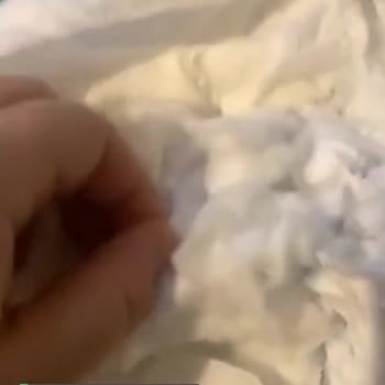 Yeni Molfix Pişik Sebebi