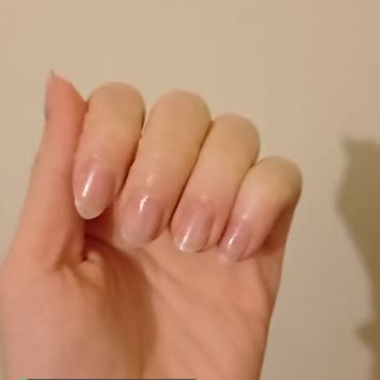 Özlem Öztürk Nails Tırnaklarım Pul Pul Dökülüyor, Tırnak Yatağımdan Dahi Kırılıyor