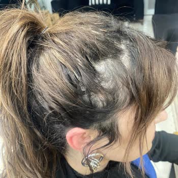 Maag Saç Sanat Kaynak İşçilik Ve Saç Kalitesizliği