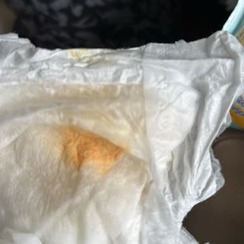 Sleepy Bebek Bezi Ve Cilt Tahrişi