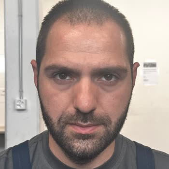 Unhappy With Estetik International Hair Transplant