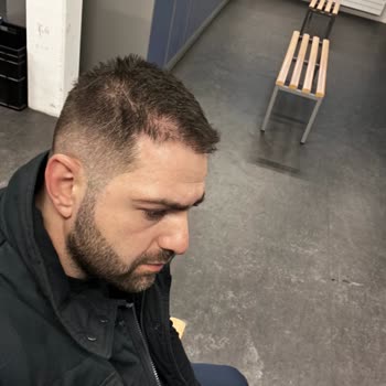 Unhappy With Estetik International Hair Transplant