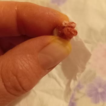 Nilüfer Ağız Ve Diş Sağlığı Sağlam Dişe Eziyetli Tedavi