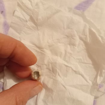 Nilüfer Ağız Ve Diş Sağlığı Sağlam Dişe Eziyetli Tedavi