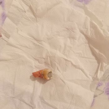 Nilüfer Ağız Ve Diş Sağlığı Sağlam Dişe Eziyetli Tedavi