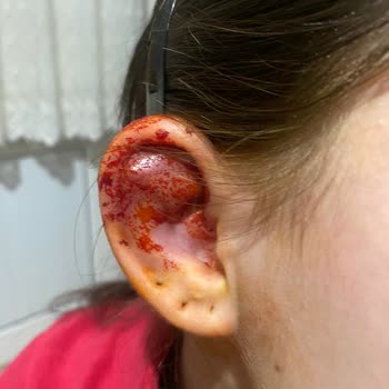 T’Lux Wellness Society Piercing İşlemi Sonucu Başımıza Gelenler