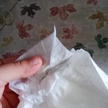 Molfix Bebek Bezinde Yabancı Cisim