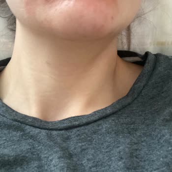 Bioderma Sebium Kerato Kremi