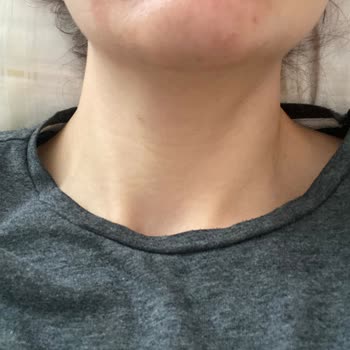 Bioderma Sebium Kerato Kremi