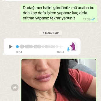 Beauty İstanbul Şikayetimi Beyan Ediyorum Sizden Ricada Bulunuyorum Mağdurum