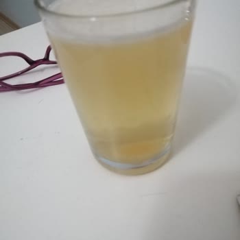 Naturalive Kolajenler Bozuk Geldi, Firma İlgisiz, Biz Paramızla Mağdur