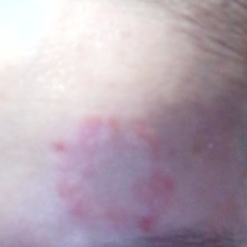 Nivea Leke Yapan Krem Sıkıntısı